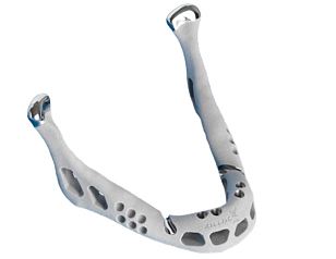 3d打印下頜骨成功移植 置換人體器官不再是夢(mèng)-e鍵打印|3D打印服務(wù)
醫(yī)療3d打印技術(shù),3D打印下頜骨,3D打印人體器官,3D打印器官,3D打印心臟,3D打印假肢,3D打印大腦,3D打印技術(shù),3D打印服務(wù),3D打印云平臺(tái)