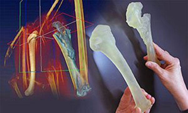 左邊是雄鷹健康的肱骨，右邊是雄鷹實(shí)際受傷的骨頭的復(fù)制品