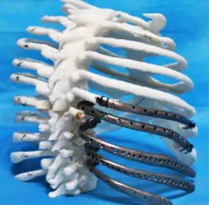 第四軍醫(yī)大學(xué)精彩分享個性化醫(yī)療3D打印的實戰(zhàn)案例與研究成果