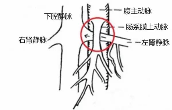 第四軍醫(yī)大學(xué)精彩分享個性化醫(yī)療3D打印的實戰(zhàn)案例與研究成果