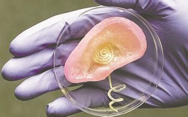 3d打印應用案例:3D打印人體器官的那些事兒 3d打印應用案例:3D打印人體器官的那些事兒