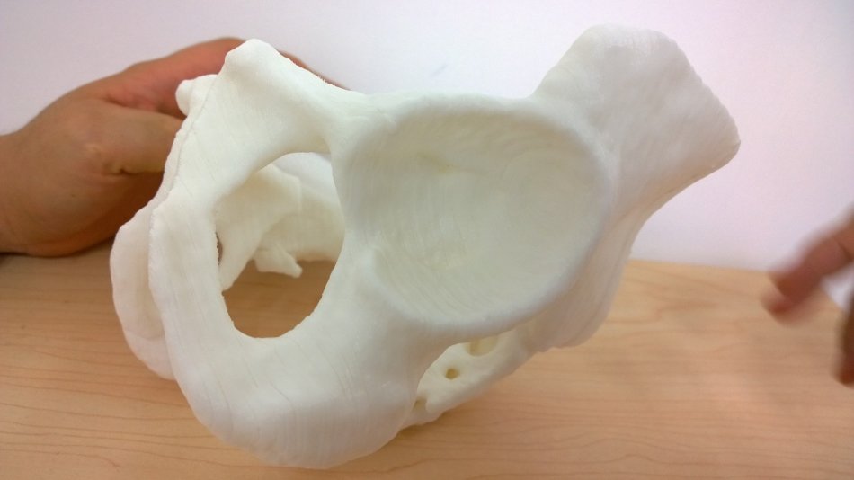 3d打印應用領域之醫療應用_e鍵打印服務公司