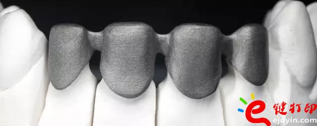醫(yī)療輔助器械的變革之路 3d打印義齒(假牙)前景無限 勢在必行_醫(yī)療設(shè)備器械3d模型打印平臺 醫(yī)療輔助器械的變革之路 3d打印義齒(假牙)前景無限 勢在必行_醫(yī)療設(shè)備器械3d模型打印平臺