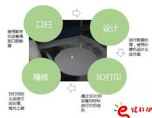 醫(yī)療輔助器械的變革之路 3d打印義齒(假牙)前景無限 勢在必行_醫(yī)療設(shè)備器械3d模型打印平臺 醫(yī)療輔助器械的變革之路 3d打印義齒(假牙)前景無限 勢在必行_醫(yī)療設(shè)備器械3d模型打印平臺