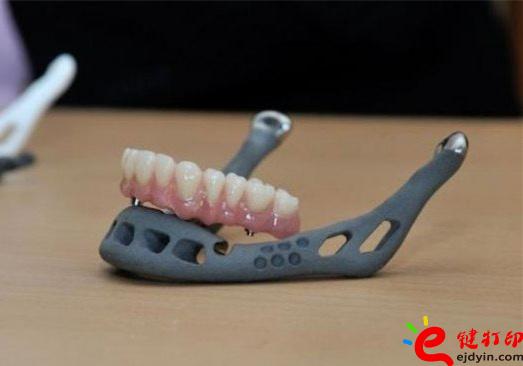 3D打印牙嵌體和牙套哪種更好？3D打印牙齒/隱形牙套/牙冠/模型/成品價(jià)格表
