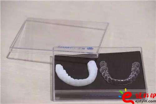 3D打印牙嵌體和牙套哪種更好？3D打印牙齒/隱形牙套/牙冠/模型/成品價(jià)格表