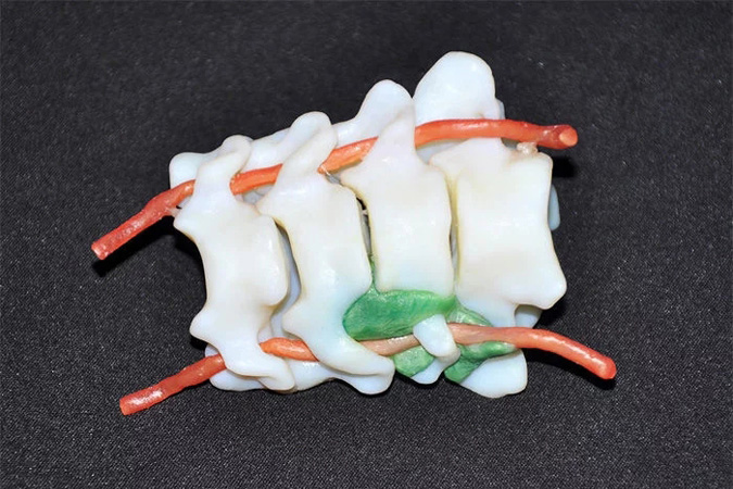 全彩3D打印應用于醫(yī)療行業(yè)的3d打印案例