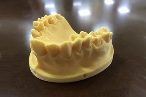 口腔齒科牙科領域的3D打印應用現狀